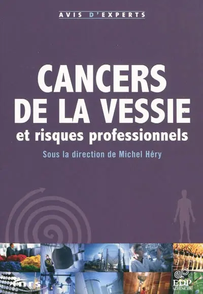 Cancers de la vessie et risques professionnels