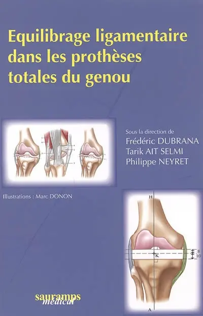 Equilibrage ligamentaire dans les prothèses totales du genou