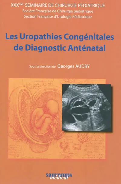 Les uropathies congénitales de diagnostic anténatal