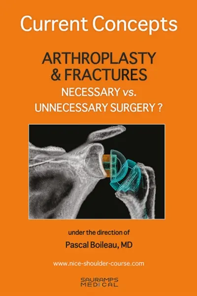Arthroplasty & fractures : necessary vs. unnecessary surgery? : current concepts Arthroplasty & fractures : necessary vs. unnecessary surgery? : current concepts
