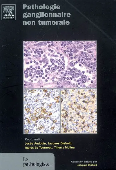 Pathologie ganglionnaire non tumorale
