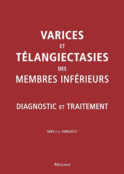 Varices et télangiectasies...
