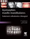 Dysmorphies maxillo-mandibulaires : traitement orthodontico-chirurgical