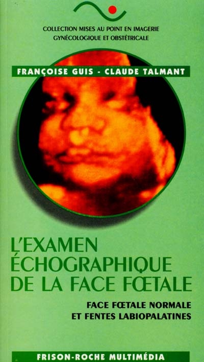 L'examen échographique de la face foetale : face foetale normale et fentes labiopalatines