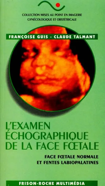 L'examen échographique de la face foetale : face foetale normale et fentes labiopalatines