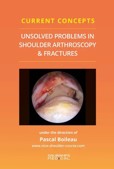 Unsolved problems in shoulder arthroscopy & fractures : current concepts Unsolved problems in shoulder arthroscopy & fractures : current concepts
