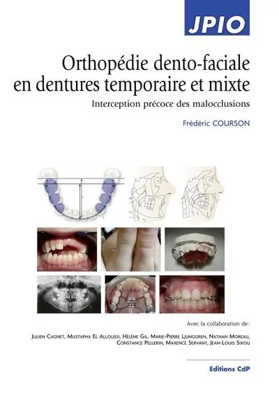 Orthopédie dento-faciale en dentures temporaire et mixte : interception précoce des malocclusions
