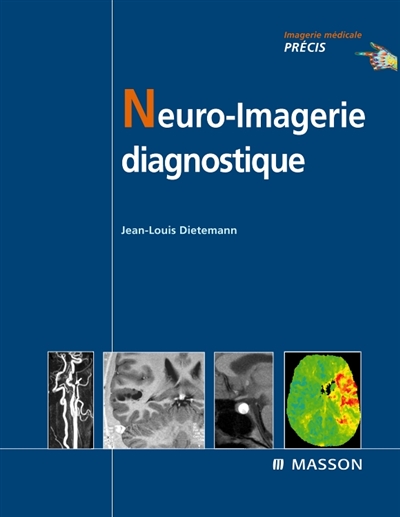 Neuro-imagerie : neuroradiologie diagnostique