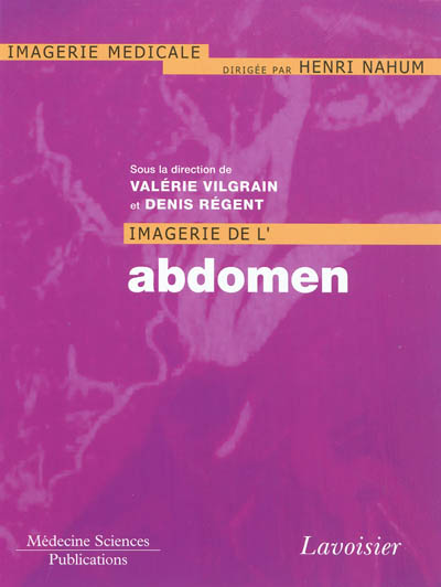 Imagerie de l'abdomen