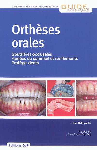 Orthèses orales : gouttières occlusales, apnées du sommeil et ronflements, protège-dents