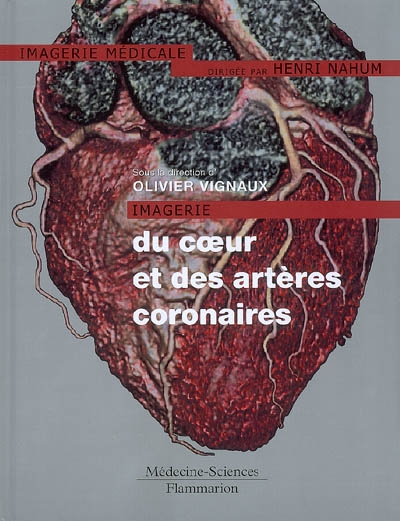 Imagerie du coeur et des artères coronaires