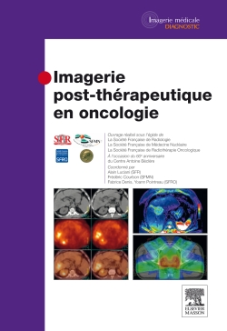 Imagerie post-thérapeutique en oncologie