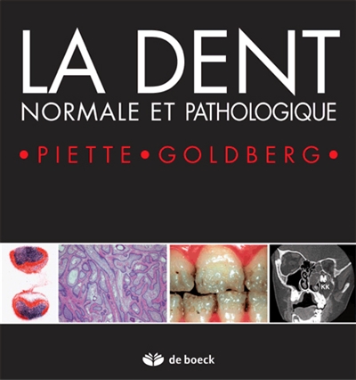 La dent normale et...