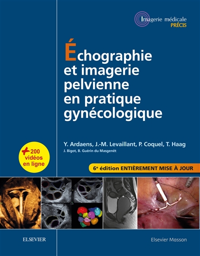 Echographie et imagerie pelvienne en pratique gynécologique