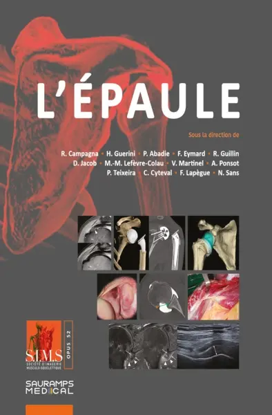 L'épaule