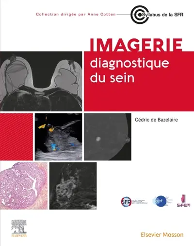 Imagerie diagnostique du sein Imagerie diagnostique du sein