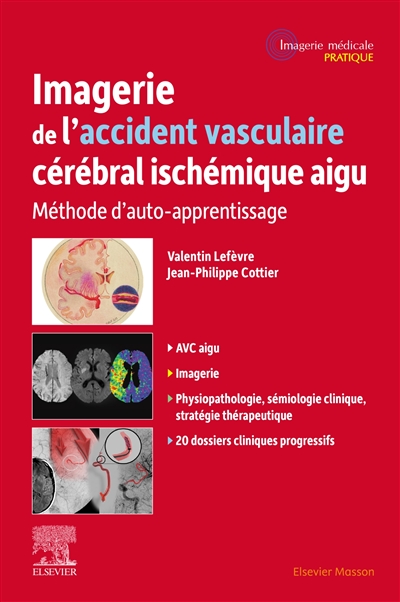 Imagerie de l'accident vasculaire cérébral ischémique aigu : méthode d'auto-apprentissage