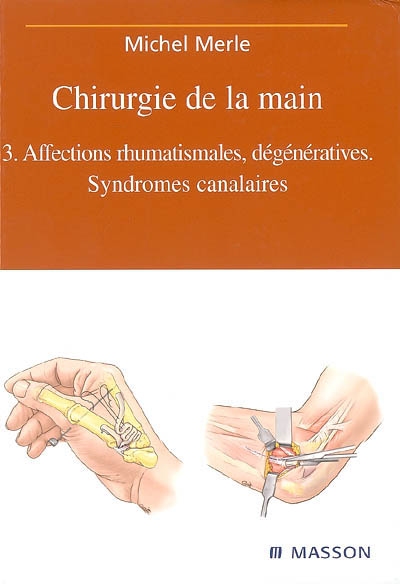Chirurgie de la main. Vol. 3. Affections rhumatismales, dégénératives : syndromes canalaires