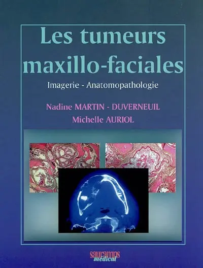 Les tumeurs maxillo-faciales : imagerie-anatomopathologie