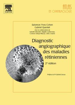 Diagnostic angiographique des maladies rétiniennes