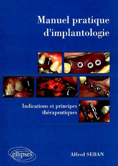 Manuel pratique d'implantologie : indications et principes thérapeutiques