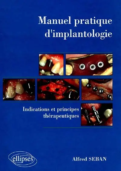 Manuel pratique d'implantologie : indications et principes thérapeutiques