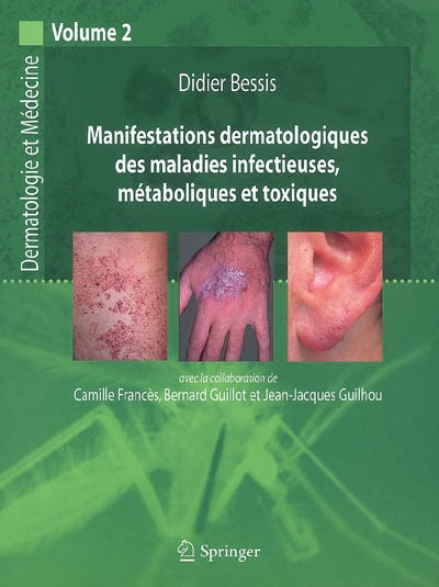 Dermatologie et médecine. Vol. 2. Manifestations dermatologiques des maladies infectieuses, métaboliques et toxiques