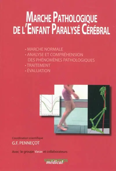 Marche pathologique de l'enfant paralysé cérébral : marche normal, analyse et compréhension des phénomènes pathologiques, traitement, évaluation