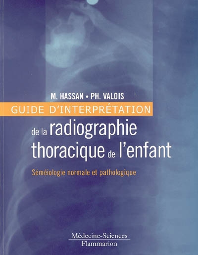Guide d'interprétation de la radiographie thoracique de l'enfant : séméiologie normale et pathologique