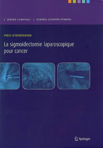 La sigmoïdectomie laparoscopique pour cancer
