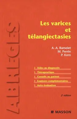 Les varices et télangiectasies