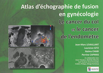 Atlas d'échographie de fusion en gynécologie : le cancer du col et le cancer de l'endomètre