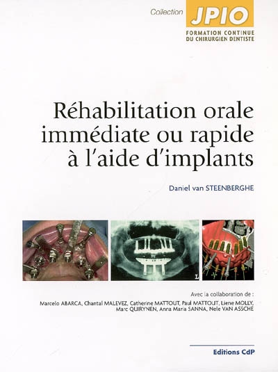 Réhabilitation orale immédiate ou rapide à l'aide d'implants