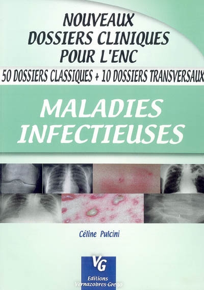 Maladies infectieuses : 50 dossiers classiques + 50 dossiers transversaux
