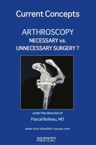 Arthroscopy : necessary vs....