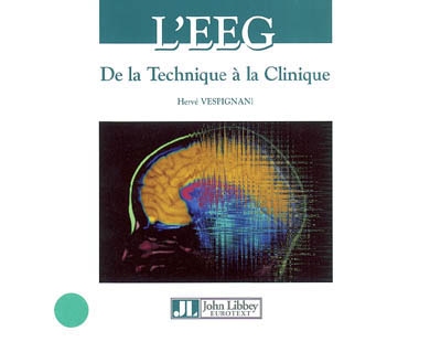 L'EEG : de la technique à la clinique