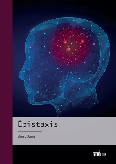 Epistaxis