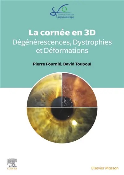 La cornée en 3D : dégénérescences, dystrophies et déformations : rapport 2025