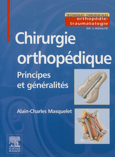 Chirurgie orthopédique : principes et généralités