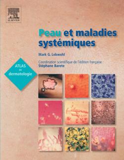 Peau et maladies systémiques