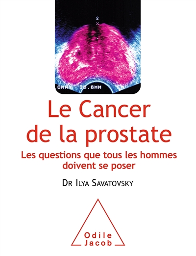 Le cancer de la prostate : les questions que tous les hommes doivent se poser
