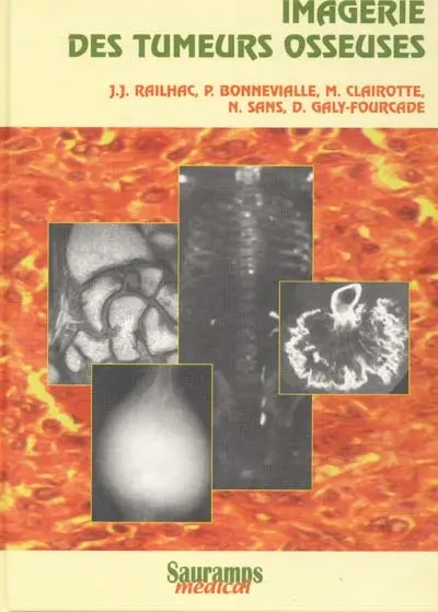 Imagerie des tumeurs osseuses