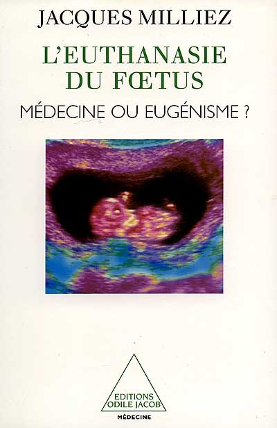L'euthanasie du foetus : médecine ou eugénisme ?