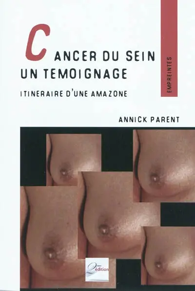 Cancer du sein, un témoignage
