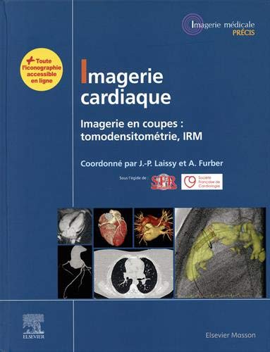 Imagerie cardiaque : imagerie en coupes : tomodensitométrie, IRM