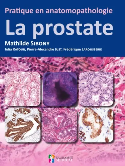 La prostate