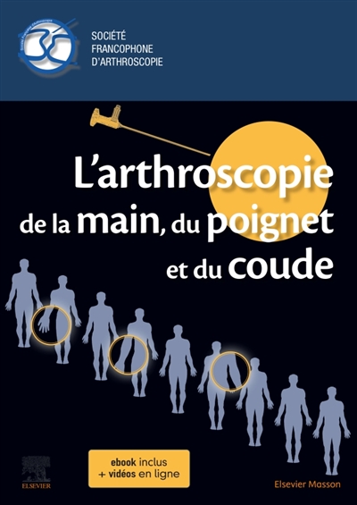 L'arthroscopie de la main,...