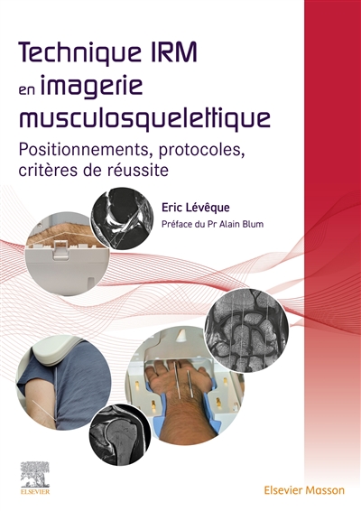 Technique IRM en imagerie musculosquelettique : positionnements, protocoles, critères de réussite