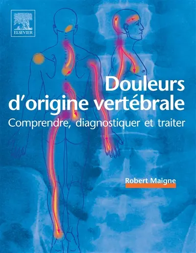 Douleurs d'origine vertébrale : comprendre, diagnostiquer et traiter Douleurs d'origine vertébrale : comprendre, diagnostiquer et traiter