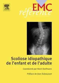 Scoliose idiopathique de l'enfant et de l'adulte